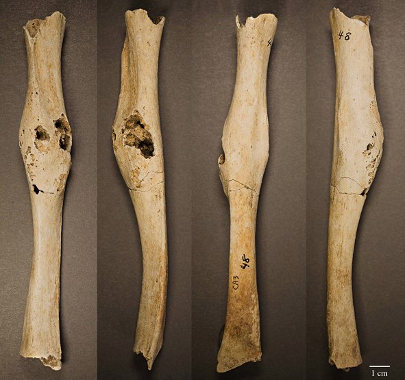 What bone's connected to the STRI bone?